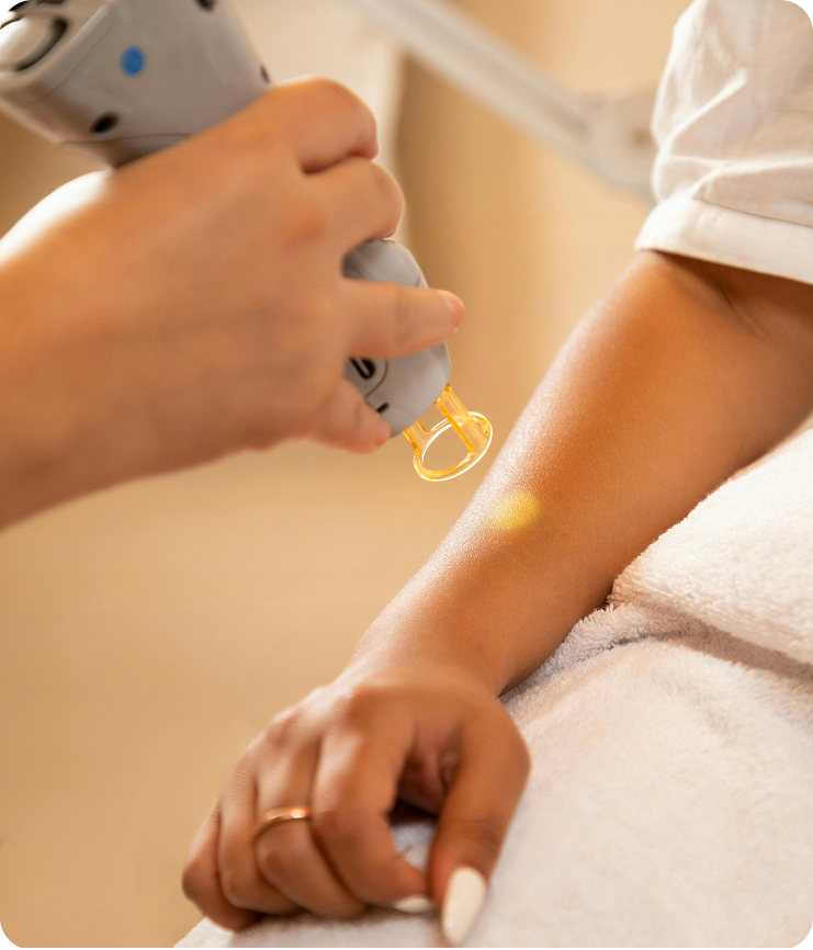 Laser Hair Removal Process
