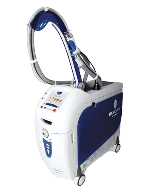 Splendor X Laser Machine